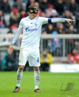Fussball 1. Bundesliga, Saison 2011/2012: Benedikt Hoewedes (FC Schalke 04) mit Maske