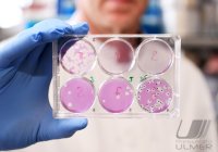 COVID-19-Medikament, Studie Phase II: Prof. Dr. Oliver Planz (UKT Tuebingen)