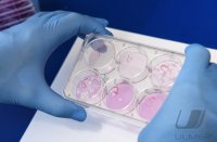 COVID-19-Medikament, Studie Phase II: Prof. Dr. Oliver Planz (UKT Tuebingen)