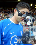 Fussball 1. Bundesliga: Bochum - Gladbach, HASHEMIAN mit Maske