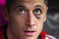 Fussball  1.Bundesliga   Saison 17/18: FC Bayern Muenchen - Borussia Moenchengladbach