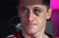 Fussball  1.Bundesliga   Saison 17/18: FC Bayern Muenchen - Borussia Moenchengladbach