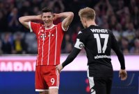 Fussball  1.Bundesliga   Saison 17/18: FC Bayern Muenchen - Borussia Moenchengladbach